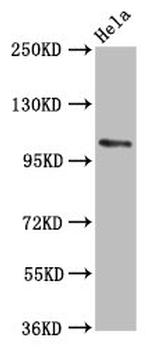 PAM Antibody in Western Blot (WB)