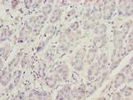 PHKG2 Antibody in Immunohistochemistry (Paraffin) (IHC (P))