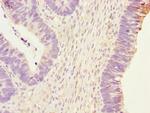 PHKG2 Antibody in Immunohistochemistry (Paraffin) (IHC (P))