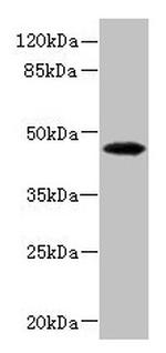 PHKG2 Antibody in Western Blot (WB)