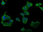 PLA2G4B Antibody in Immunocytochemistry (ICC/IF)