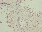 PMPCB Antibody in Immunohistochemistry (Paraffin) (IHC (P))