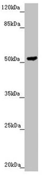 PMPCB Antibody in Western Blot (WB)