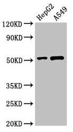 PNLIPRP2 Antibody in Western Blot (WB)