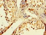 POLB Antibody in Immunohistochemistry (Paraffin) (IHC (P))