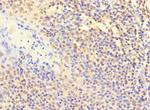 POLB Antibody in Immunohistochemistry (Paraffin) (IHC (P))