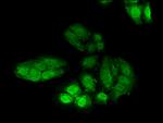 POLH Antibody in Immunocytochemistry (ICC/IF)