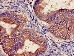 POLH Antibody in Immunohistochemistry (Paraffin) (IHC (P))