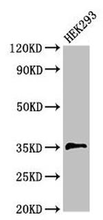 PPT1 Antibody in Western Blot (WB)