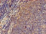 PRKAR2A Antibody in Immunohistochemistry (Paraffin) (IHC (P))