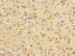 PRMT3 Antibody in Immunohistochemistry (Paraffin) (IHC (P))