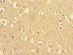 Presenilin 1 Antibody in Immunohistochemistry (Paraffin) (IHC (P))