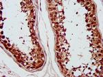 PSMC6 Antibody in Immunohistochemistry (Paraffin) (IHC (P))