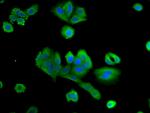 PTX3 Antibody in Immunocytochemistry (ICC/IF)