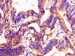 PTX3 Antibody in Immunohistochemistry (Paraffin) (IHC (P))