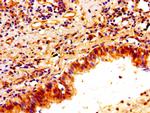 PTX3 Antibody in Immunohistochemistry (Paraffin) (IHC (P))