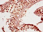 RAB25 Antibody in Immunohistochemistry (Paraffin) (IHC (P))