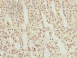 RAB9 Antibody in Immunohistochemistry (Paraffin) (IHC (P))