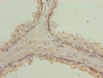 RAB9 Antibody in Immunohistochemistry (Paraffin) (IHC (P))