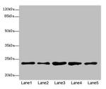 RAB9 Antibody in Western Blot (WB)