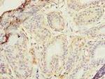 RAD23B Antibody in Immunohistochemistry (Paraffin) (IHC (P))