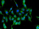 RARS Antibody in Immunocytochemistry (ICC/IF)