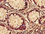 RARS Antibody in Immunohistochemistry (Paraffin) (IHC (P))