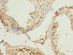 REC8 Antibody in Immunohistochemistry (Paraffin) (IHC (P))