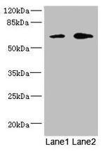 REC8 Antibody in Western Blot (WB)