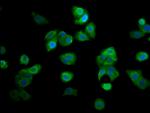 RECQ4 Antibody in Immunocytochemistry (ICC/IF)