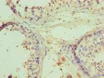 RNF8 Antibody in Immunohistochemistry (Paraffin) (IHC (P))