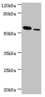 RNF8 Antibody in Western Blot (WB)