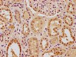 PTBP3 Antibody in Immunohistochemistry (Paraffin) (IHC (P))