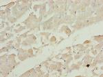 RRAS2 Antibody in Immunohistochemistry (Paraffin) (IHC (P))