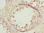 RRAS2 Antibody in Immunohistochemistry (Paraffin) (IHC (P))