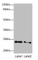 RRAS2 Antibody in Western Blot (WB)