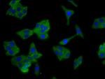 SCNN1B Antibody in Immunocytochemistry (ICC/IF)