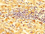 SCNN1B Antibody in Immunohistochemistry (Paraffin) (IHC (P))