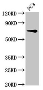 SCNN1B Antibody in Western Blot (WB)
