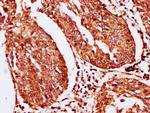 SERPINB2 Antibody in Immunohistochemistry (Paraffin) (IHC (P))