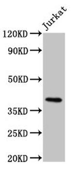 HLA-G Antibody in Western Blot (WB)