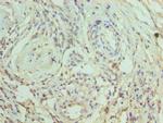 CRACC Antibody in Immunohistochemistry (Paraffin) (IHC (P))