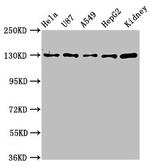 NKCC1 Antibody in Western Blot (WB)