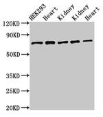 SLC25A12 Antibody in Western Blot (WB)