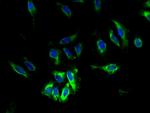 TAUT Antibody in Immunocytochemistry (ICC/IF)