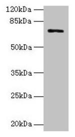 TAUT Antibody in Western Blot (WB)