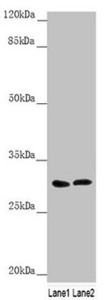 SNAP29 Antibody in Western Blot (WB)