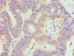 SPTLC1 Antibody in Immunohistochemistry (Paraffin) (IHC (P))