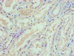 SPTLC1 Antibody in Immunohistochemistry (Paraffin) (IHC (P))