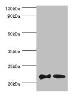 Sorcin Antibody in Western Blot (WB)